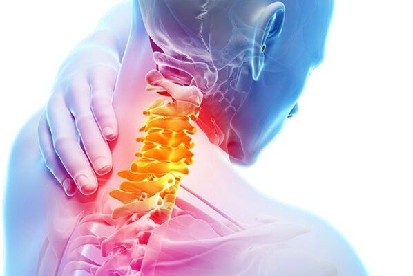 Příčiny krční osteochondózy