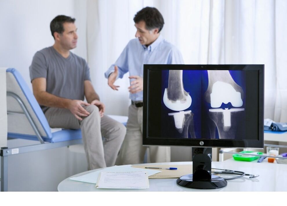 Artrtrosis of kolenní kloub na obrázku x -ray